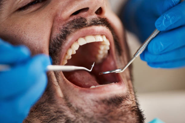 Best Emergency Gum Treatment in Berkshire Lakes, FL
