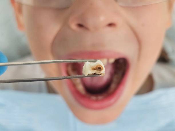 Best Emergency TMJ Treatment in Berkshire Lakes, FL